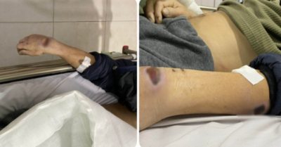 Tin trưa 11/11: Bắt 2 cựu đội trưởng, đội phó công an ở Thái Bình vì dùng nhục hình; Ukraine giành lại 41 khu dân cư ở tỉnh Kherson