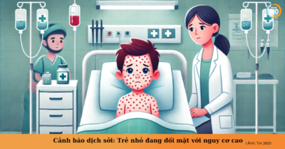 Dịch sởi bùng phát tại Hà Nội: Bé gái 4 tuổi tử vong