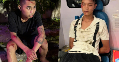 Hà Nội: Hai thanh niên lao vào đường cấm, tông trực diện chiến sĩ CSCĐ nhập viện cấp cứu