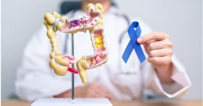 5 dấu hiệu ung thư đại tràng phổ biến cần phát hiện sớm để tăng cơ hội chữa trị
