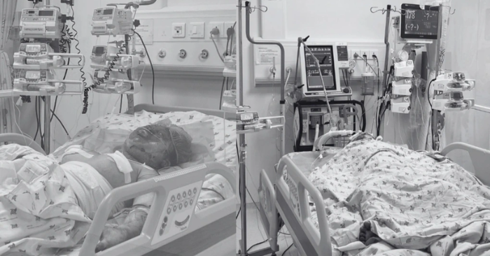Hai cháu bé bỏng nặng nghi bị cha ruột tưới xăng đốt ở Tây Ninh