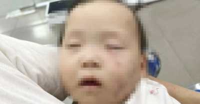Giáo viên mầm non bị tạm giữ vì bạo hành trẻ