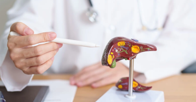 Bí ẩn khối u gan 6 cm tự biến mất tại Đài Loan