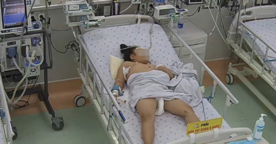 Sốt xuất huyết Dengue: Cảnh báo suy gan nặng ở trẻ em
