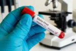 Dịch bệnh Ebola: Việt Nam khẩn trương triển khai biện pháp ngăn chặn virus xâm nhập