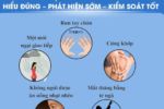 Cảnh báo: Bệnh thoái hóa thần kinh Parkinson nguy hiểm nhưng dễ nhầm lẫn với lão hóa