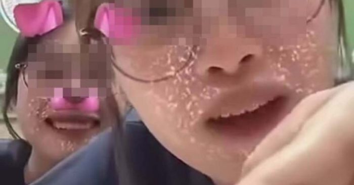 Hai nữ sinh y khoa bị đình chỉ học một năm vì livestream phản cảm