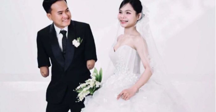 Chuyện tình giúp chàng trai cụt hai tay đổi thay