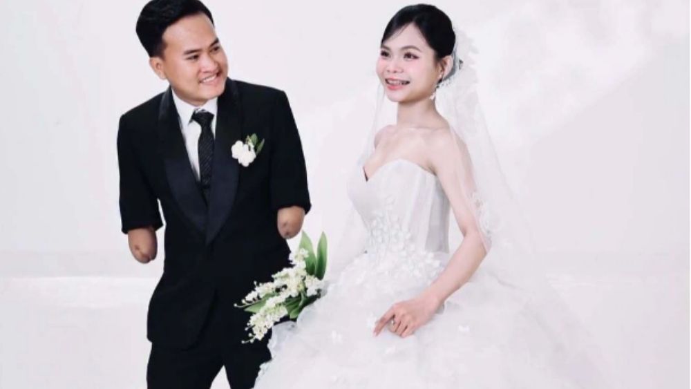 Chuyện tình giúp chàng trai cụt hai tay đổi thay