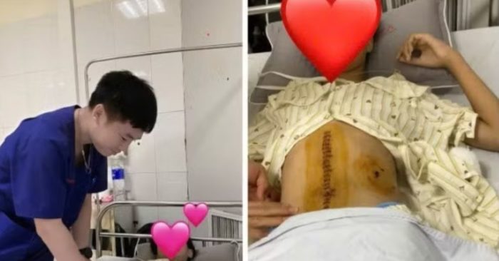 Ngã xe đạp điện, nữ sinh 15 tuổi phải cắt lách và thận để giữ mạng