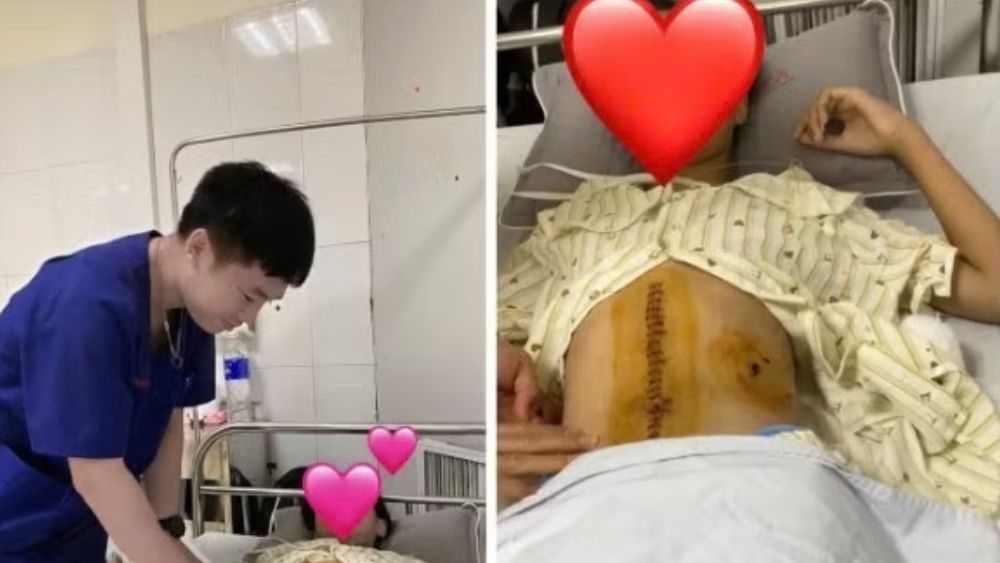 Nữ sinh 15 tuổi ngã xe đạp điện phải cắt lách, thận