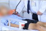 Tỉnh táo sau tai nạn, hôm sau nguy kịch vì tụ máu ngoài màng cứng